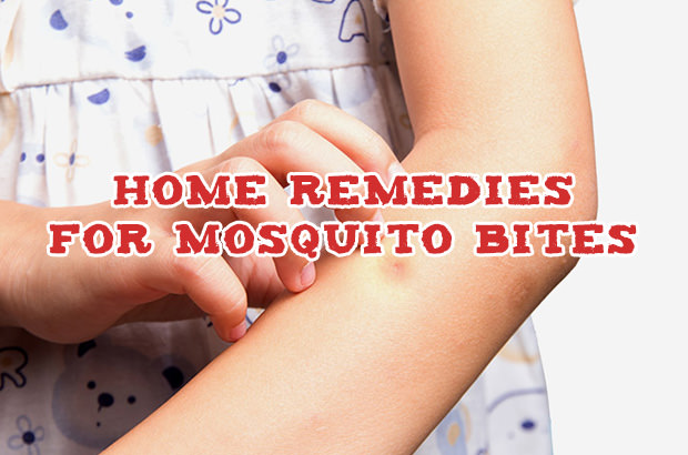 Home Remedies For Mosquito Bites