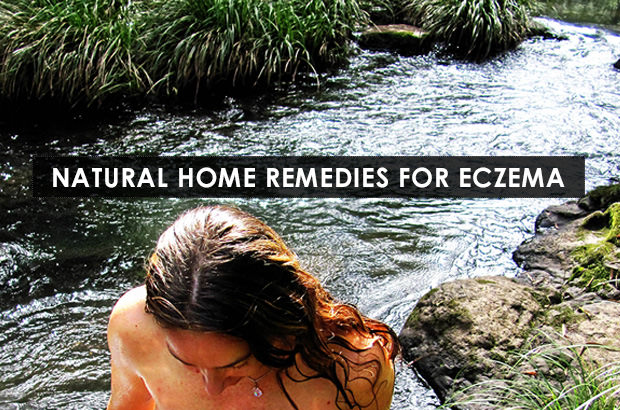 Natural Home Remedies For Eczema
