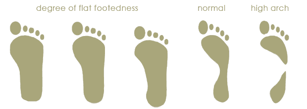 foot arch chart