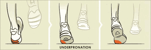 underpronation diagram