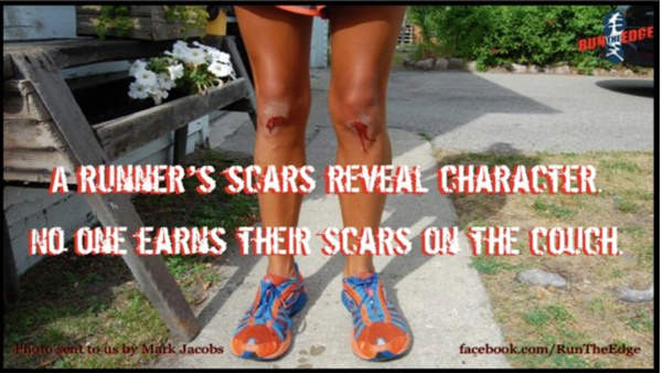 Inspirational Messages To Get You Off That Couch And Go Running #26: A runner's scars reveal character. No one earns their scars on the couch.